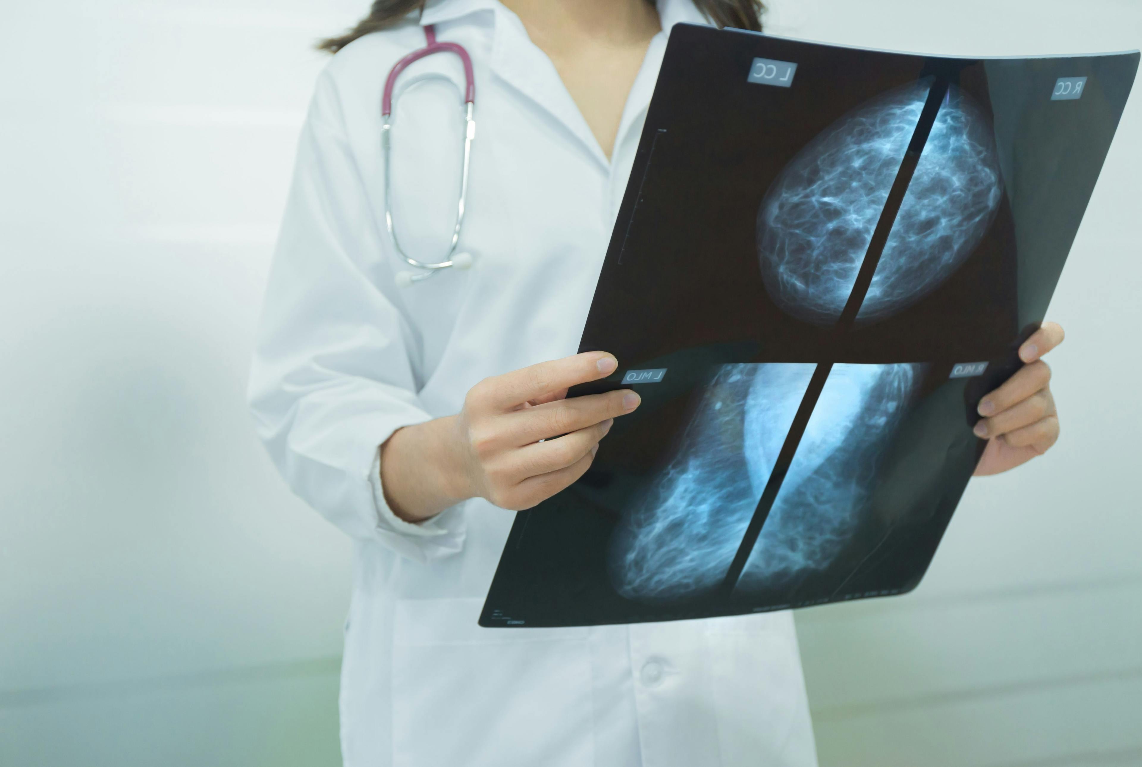 Selective focus Mammogram film image in female doctor hands.