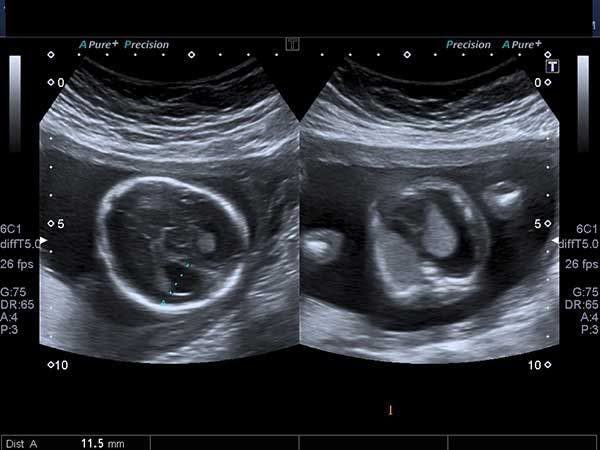 Daily Dx: Second Trimester Fetus