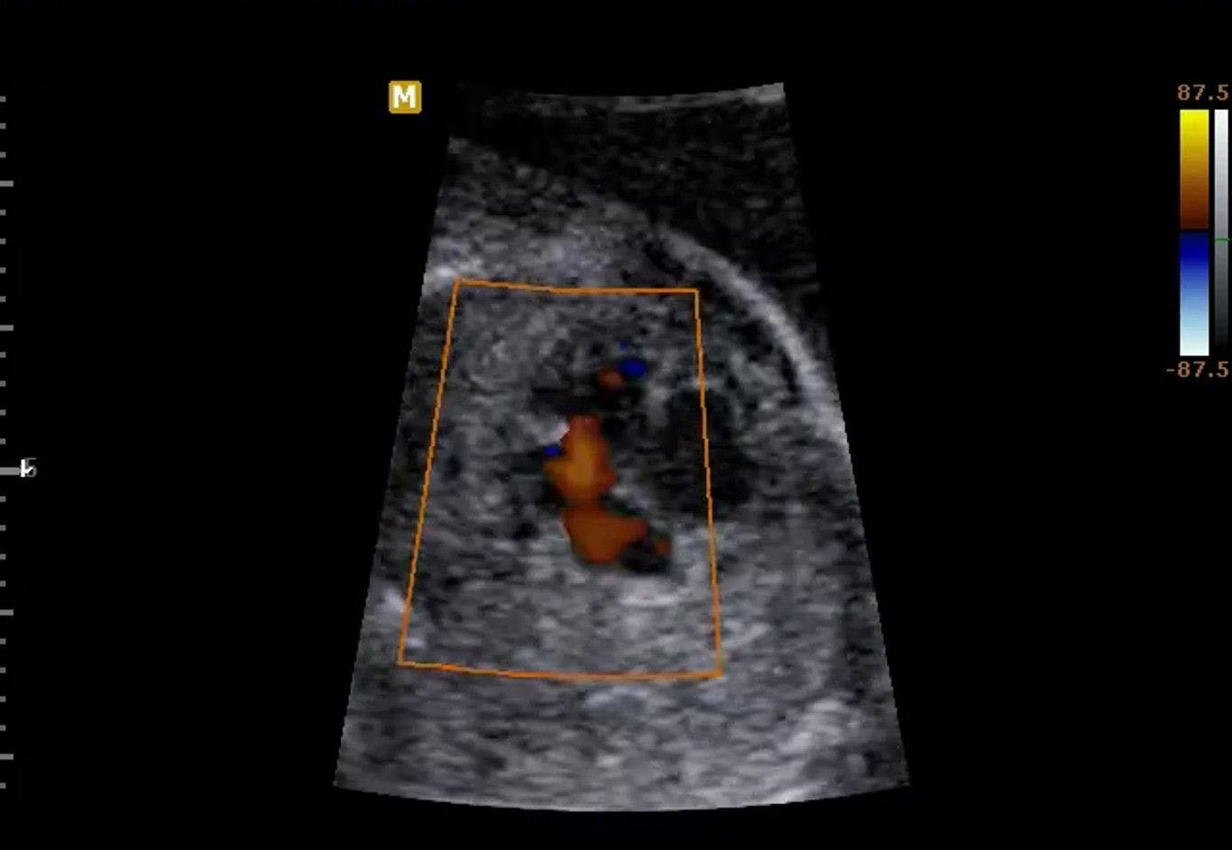 Image IQ: Fetal Echo Images