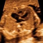 Image IQ: The Fetal Heart