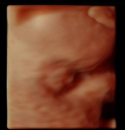 Image IQ: Fetal Anatomy