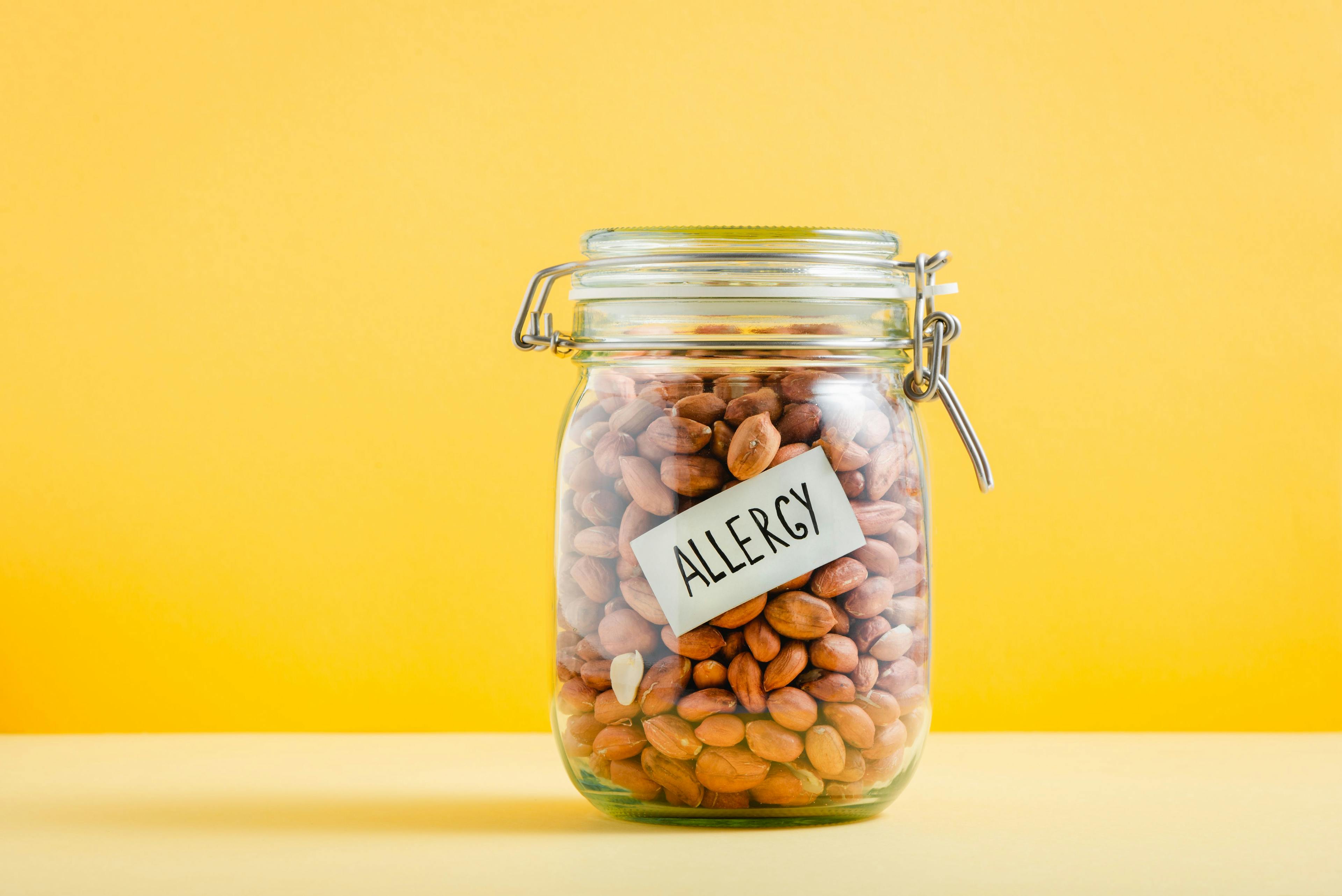 Essential advice to prevent food allergies